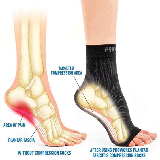 Shows area of pain on foot on Plantar Fascia